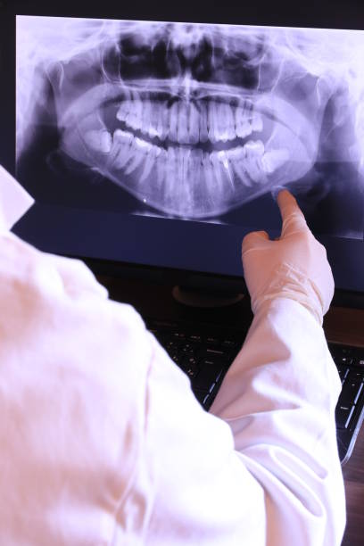 Best Emergency Dental Care for Abscessed Tooth in Hinton, WV