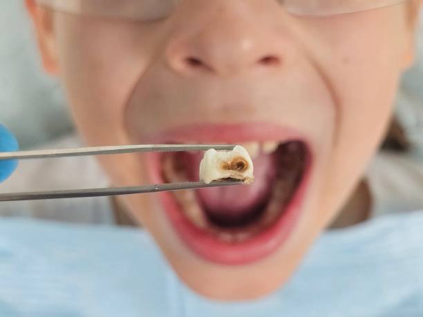 Best Holiday Emergency Dentist in Hinton, WV